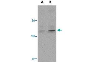 Western blot analysis of CENPO in mouse kidney tissue lysate with CENPO polyclonal antibody  at (A) 1 and (B) 2 ug/mL . (CENPO anticorps  (Internal Region))