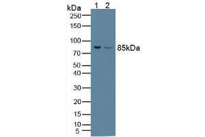 Figure. (PFKP anticorps  (AA 247-473))