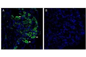 Expression of GPR35 in rat dorsal root ganglion.
