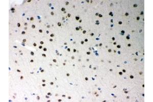 IHC testing of FFPE mouse brain with SF2 antibody. (SRSF1 anticorps)