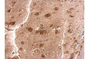 IHC-P Image RPS3A antibody detects RPS3A protein at cytosol on mouse brain stem by immunohistochemical analysis. (RPS3A anticorps)