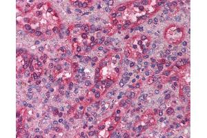 Anti-LHX1 antibody IHC of human spleen.