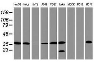 Image no. 2 for anti-Apurinic/Apyrimidinic Endonuclease 1 (APEX1) (AA 1-242) antibody (ABIN1490625) (APEX1 anticorps  (AA 1-242))