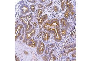 IHC analysis of Optineurin using anti-Optineurin antibody (ABIN3042498). (OPTN anticorps  (AA 241-577))