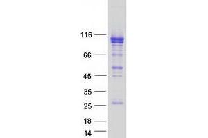Validation with Western Blot (OSBPL5 Protein (Transcript Variant 3) (Myc-DYKDDDDK Tag))