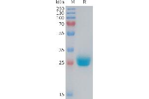 Mouse CXADR Protein, His Tag on SDS-PAGE under reducing condition.