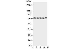 Western blot testing of COX2 antibody and Lane 1:  human placenta;  2: COLO320;  3: HeLa;  4: PANC;  5: SKOV cell lysate.