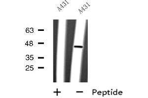 Western blot analysis of CYLC2 expression in A431 whole cell lysate ,The lane on the left is treated with the antigen-specific peptide. (CYLC2 anticorps  (C-Term))