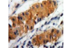 IHC-P analysis of Stomach tissue, with DAB staining. (ALOX15 anticorps  (AA 170-312))