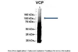 Amount and Sample Type : 500 ug Human NT2 cell lysate Amount of IP Antibody : 6 ug Primary Antibody : VCP Primary Antibody Dilution : 1:500 Secondary Antibody : Goat anti-rabbit Alexa-Fluor 594 Secondary Antibody Dilution : 1:5000 Gene Name : VCP Submitted by : Dr. (VCP anticorps  (C-Term))