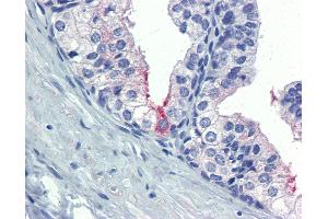 Anti-AMH antibody IHC of human prostate. (AMH anticorps  (AA 468-517))
