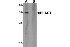 Western blot analysis of PLAC1 in human placenta tissue lysate with PLAC1 antibody at 1 μg/ml in (A) the absence and (B) the presence of blocking peptide. (PLAC1 anticorps  (C-Term))