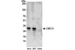 anti-CWC15 Spliceosome-Associated Protein Homolog (CWC15) (AA 75-125) antibody