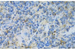 Immunohistochemistry of paraffin-embedded Rat spleen using RPL13 Polyclonal Antibody at dilution of 1:100 (40x lens).