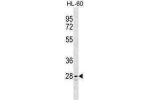TLCD1 Antibody (C-term) western blot analysis in HL-60 cell line lysates (35 µg/lane). (TLCD1 anticorps  (C-Term))