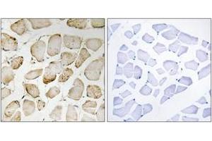 Immunohistochemistry analysis of paraffin-embedded human skeletal muscle tissue, using Arachidonate 5 Lipoxygenase (Ab-271) Antibody. (ALOX5 anticorps  (AA 246-295))
