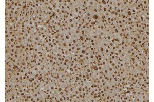 ABIN6277130 at 1/100 staining Mouse liver tissue by IHC-P. (SCCPDH anticorps)