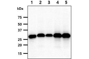 The cell lysates(40ug) were resolved by SDS-PAGE, transferred to PVDF membrane and probed with anti-human FHL2 antibody (1:1000). (FHL2 anticorps)