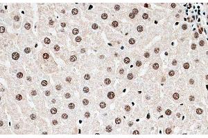Immunohistochemistry of paraffin-embedded Rat liver using CBX6 Polyclonal Antibody at dilution of 1:100 (40x lens). (CBX6 anticorps)