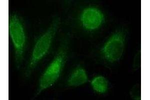 ODZ3 polyclonal antibody (Cat # PAB11565, 10 ug/mL) staining of nuclei HeLa cells (green). (TENM3 anticorps)