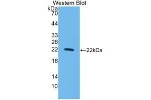 Detection of Recombinant IL10, Rat using Monoclonal Antibody to Interleukin 10 (IL10) (IL-10 anticorps  (AA 19-178))