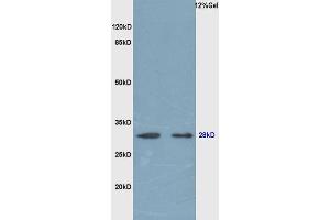 Rat lung lysates probed (ABIN679718) at 1:200 in 4 °C.