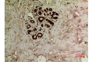 Immunohistochemical analysis of paraffin-embedded human-breast, antibody was diluted at 1:100. (alpha Tubulin anticorps  (acLys40))
