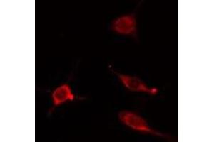 ABIN6275201 staining Hela cells by IF/ICC. (IQCB1 anticorps  (Internal Region))