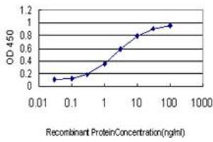Detection limit for recombinant GST tagged TRIM63 is approximately 0.