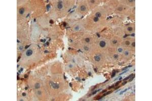 Used in DAB staining on fromalin fixed paraffin-embedded liver tissue (SAA2 anticorps  (AA 20-122))