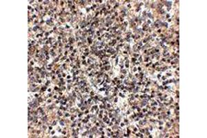 Immunohistochemistry of RSPO1 in human spleen tissue with RSPO1 polyclonal antibody  at 2. (RSPO1 anticorps  (N-Term))
