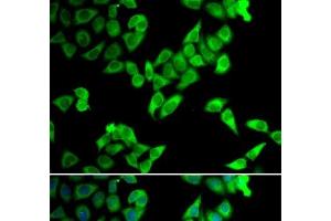 Immunofluorescence analysis of U2OS cells using TRIP10 Polyclonal Antibody (TRIP10 anticorps)