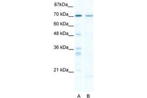 Western Blotting (WB) image for anti-SRY (Sex Determining Region Y)-Box 13 (SOX13) antibody (ABIN2460793)
