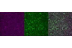 Immunohistochemistry (IHC) image for anti-Protein Phosphatase 1, Regulatory (Inhibitor) Subunit 1B (PPP1R1B) antibody (ABIN7456009)