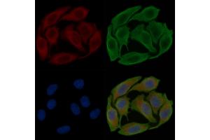 ABIN6258609 and ABIN6274191 staining Hela cells(30 min of UV treatment) by IF/ICC.