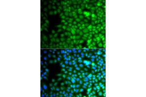 Immunofluorescence analysis of A549 cells using ZNF195 antibody (ABIN4905676). (ZNF195 anticorps)