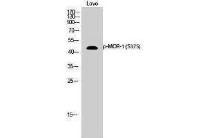 Western Blotting (WB) image for anti-Opioid Receptor, mu 1 (OPRM1) (pSer375) antibody (ABIN3182830) (Mu Opioid Receptor 1 anticorps  (pSer375))