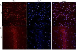 ABIN5539690 (5ug/ml) staining of paraffin embedded Rat Cerebral Cortex (A) and Rat Hippocampus (B), CRY-staining with DAPI nuclear counter stain in blue. (BDNF anticorps  (Internal Region))