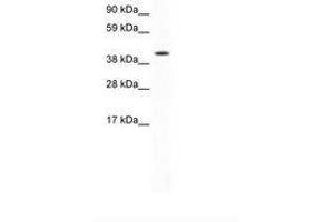 Image no. 1 for anti-Forkhead Box F1 (FOXF1) (AA 276-325) antibody (ABIN202323) (FOXF1 anticorps  (AA 276-325))
