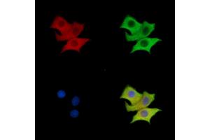 GAB3 Antibody staining HepG2 cells by IF/ICC. (GAB3 anticorps)