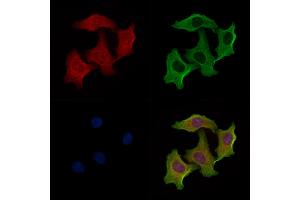 ABIN6258925 and ABIN6274995 staining Hela cells by IF/ICC. (CBLN2 anticorps  (N-Term))