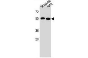 Western blot analysis of LRRC6 Antibody (Center) in NCI-H460,A549 cell line lysates (35ug/lane).