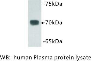 Image no. 1 for anti-Complement C3 beta Chain (C3b) antibody (ABIN1112803) (Complement C3b anticorps)