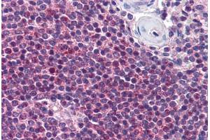 Human Spleen (formalin-fixed, paraffin-embedded) stained with NIACR2 antibody ABIN290337 at 10 ug/ml followed by biotinylated goat anti-rabbit IgG secondary antibody ABIN481713, alkaline phosphatase-streptavidin and chromogen. (GPR109B anticorps  (AA 1-50))