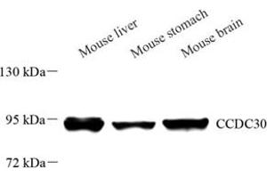 Western blot analysis of CCDC30 (ABIN7073536) at dilution of 1: 500 (CCDC30 anticorps)