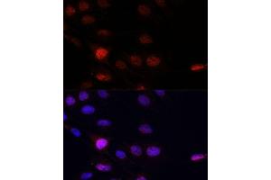 Immunofluorescence analysis of C6 cells using KLHL8 antibody (ABIN7268081) at dilution of 1:100. (KLHL8 anticorps  (AA 271-620))