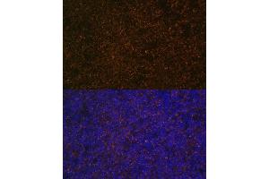 Immunofluorescence analysis of rat spleen using CR2/CD21 Polyclonal Antibody (ABIN6132246, ABIN6138992, ABIN6138993 and ABIN6224458) at dilution of 1:100 (40x lens).