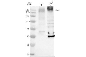 Western blot analysis of SETX using anti-SETX antibody (ABIN7825795).