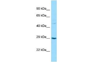 Western Blotting (WB) image for anti-Transforming Growth Factor beta Regulator 1 (TBRG1) (C-Term) antibody (ABIN2788524)