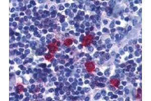 Immunohistochemistry of BAFF Receptor in human tonsil tissue with BAFF Receptor antibody at 5 μg/ml.